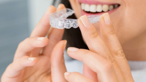Common Clear Aligner Mistakes to Avoid for Safety