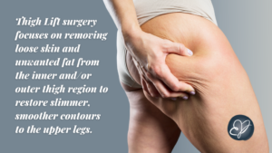 Thigh Lift Surgery: How It Can Refine Your Lower Body Contours